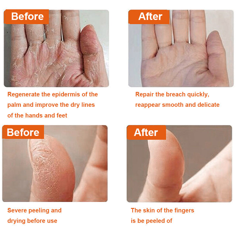 Anti-cracking Winter Cream