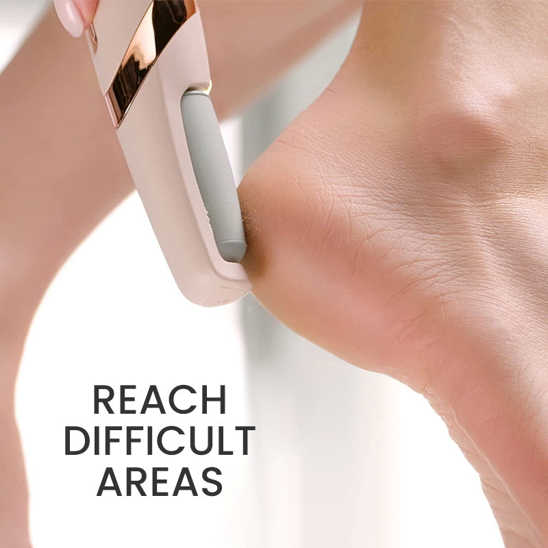 Rechargeable Electric Foot Callus Remover