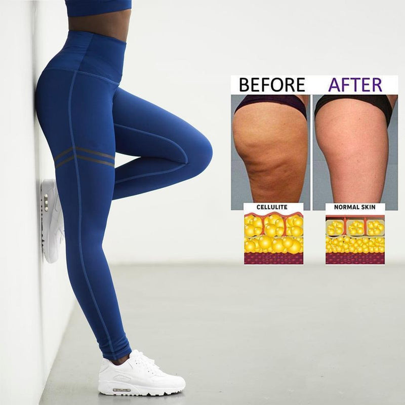 Women's Anti-cellulite Compression Leggings