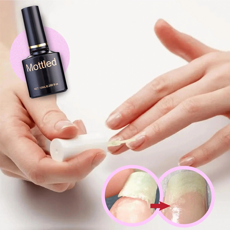 🔥2022 Sunmer Hot Sale🔥NAIL REPAIR PROTECTION GEL